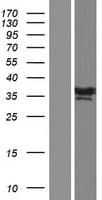 Human C1orf226 Protein (Over-Expression Lysate Myc-DDK (Flag))