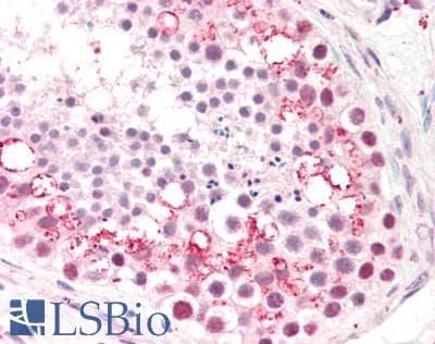 IHC-plus™ PUM2 Antibody (aa141-155)