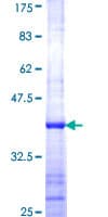 Human RPL23 / Ribosomal Protein L23 (Recombinant GST, N-terminus)