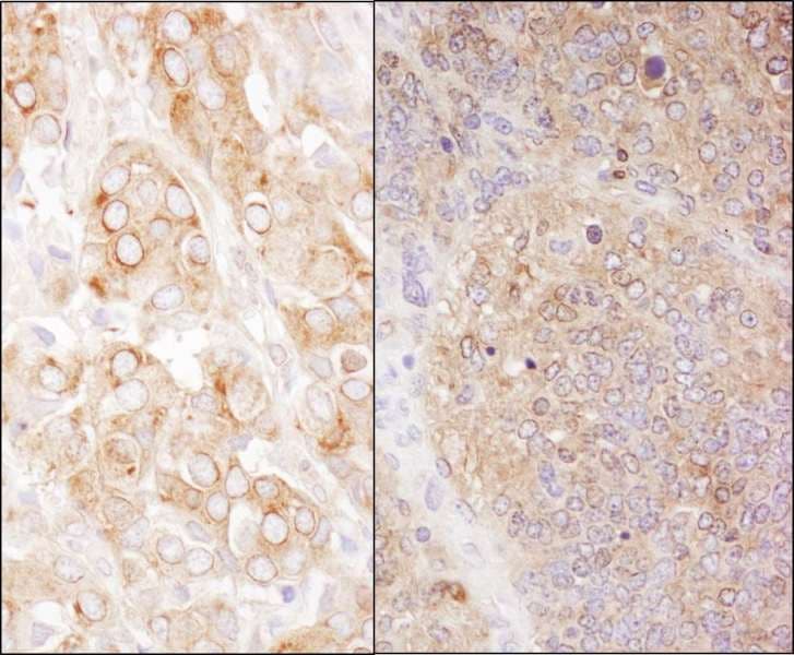 Polyclonal Rabbit anti-Human EEF2 / Elongation Factor 2 Antibody (aa808-858, IHC, WB)