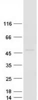 Human ACP6 Protein (Recombinant Myc-DDK (Flag))