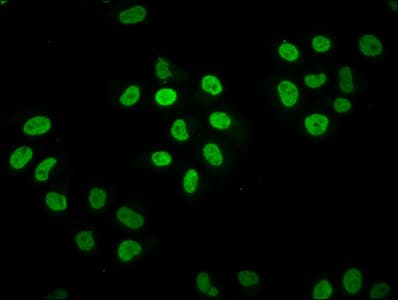 Polyclonal Rabbit anti-Human HIST1H2BN Antibody (IHC, IF)