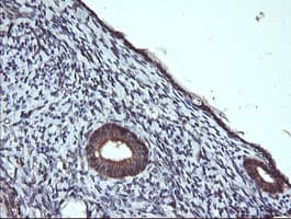 CD45 / LCA Antibody (clone OTI1B7, Carrier-free)