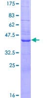 Human SPC18 / SEC11A Protein (Recombinant GST)