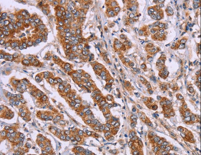 DCTN6 / Dynactin 6 Antibody