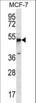 Polyclonal Rabbit anti-Human FKSG89 / MBOAT4 Antibody (aa258-287, IHC, WB)