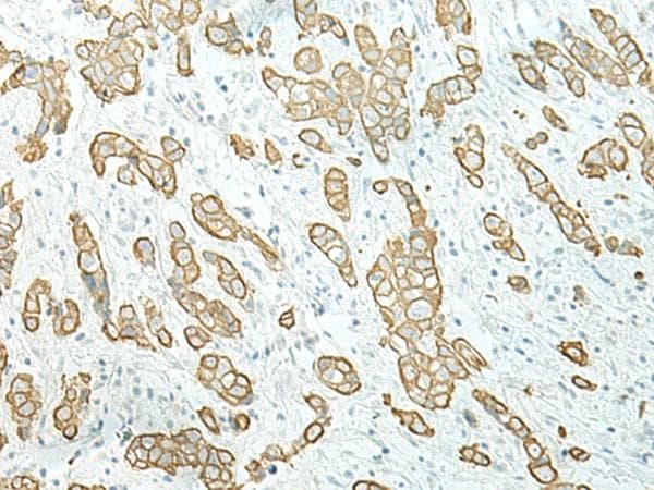 ETAA1 Antibody