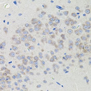 ATF6 Antibody