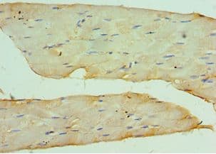CSRP2BP Antibody (aa523-782)