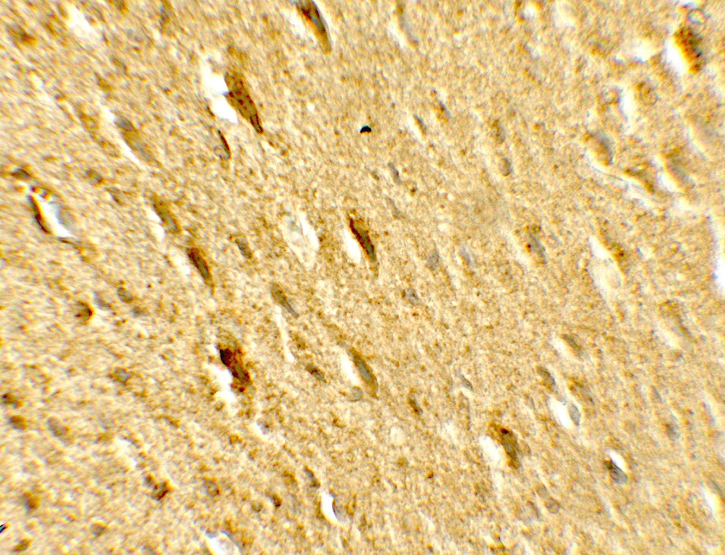 IHC-plus™ Polyclonal Rabbit anti-Human GABARAPL2 / ATG8 Antibody (IHC, IF, WB)