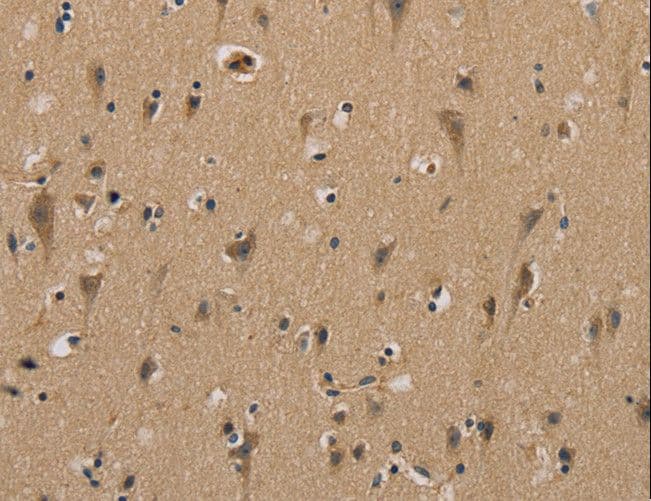 Polyclonal Rabbit anti-Human MYL3 Antibody (IHC, WB)
