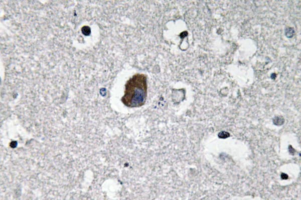 Polyclonal Rabbit anti-Human ABCB1 / MDR1 / P Glycoprotein Antibody (Ile583, IHC)