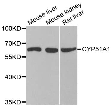 CYP51A1 / CYP51 Antibody