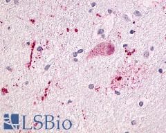 PathPlus™ NTSR1 / NTR Antibody (Cytoplasmic Domain)