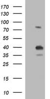 UPRT Antibody (clone OTI2D1)