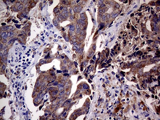 p16INK4a / CDKN2A Antibody (clone OTI11A6)