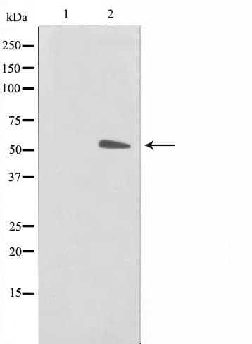 KRT15 / CK15 / Cytokeratin 15 Antibody