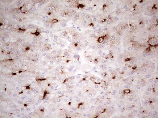 ABCB1 / MDR1 / P Glycoprotein Antibody (aa995-1280, clone OTI10H3)