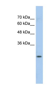 GSTM1 Antibody (aa31-80)