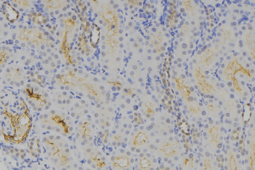 Polyclonal Rabbit anti-Human RAB3GAP1 Antibody (IHC, IF, WB)