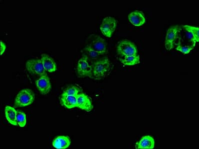 Polyclonal Rabbit anti-Human TBC1D9B Antibody (IHC)