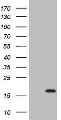 C17orf58 Antibody (clone OTI6E9)