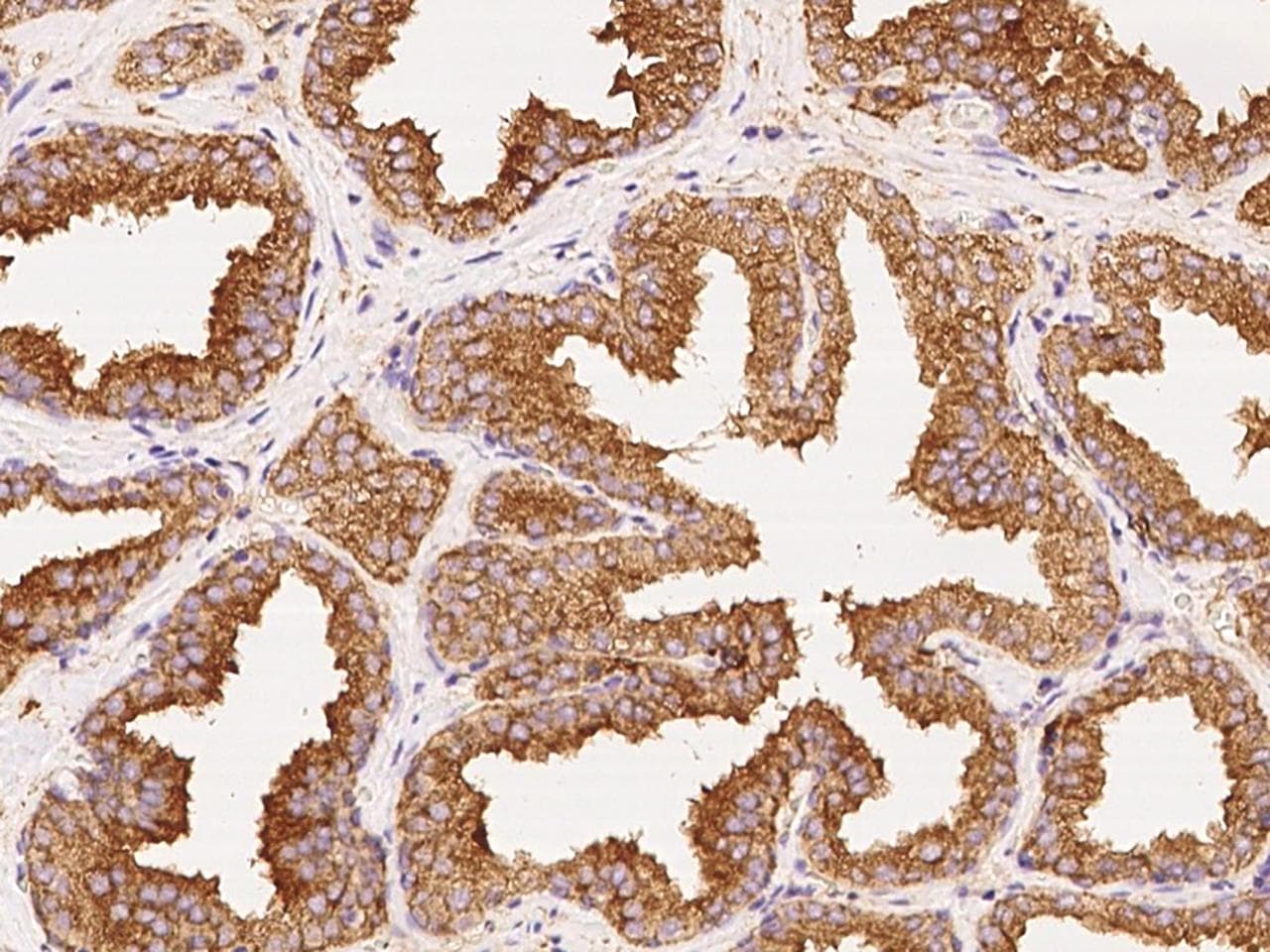 Polyclonal Rabbit anti-Human CD151 Antibody (IHC)