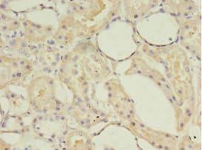 ACOT9 Antibody