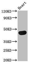 TRDMT1 / DNMT2 Antibody