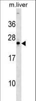 NOG / Noggin Antibody (aa84-111)
