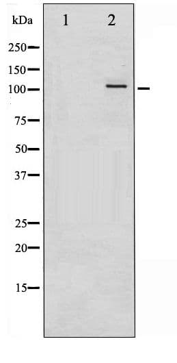 PKD1/2/3 / PKC Mu Antibody (phospho-Ser738/742)