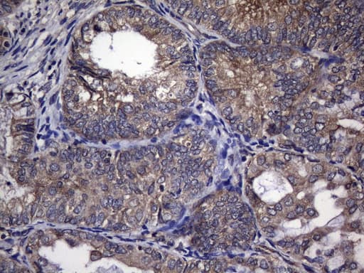 Monoclonal Mouse anti-Human TRIM56 Antibody (clone OTI8E12, aa311-554, IHC, WB)