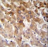 Polyclonal Rabbit anti-Human MBTD1 Antibody (aa564-592, IHC, WB)