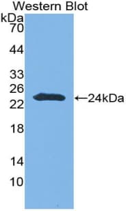 CNTNAP4 / CASPR4 Antibody (aa706-886, PE)