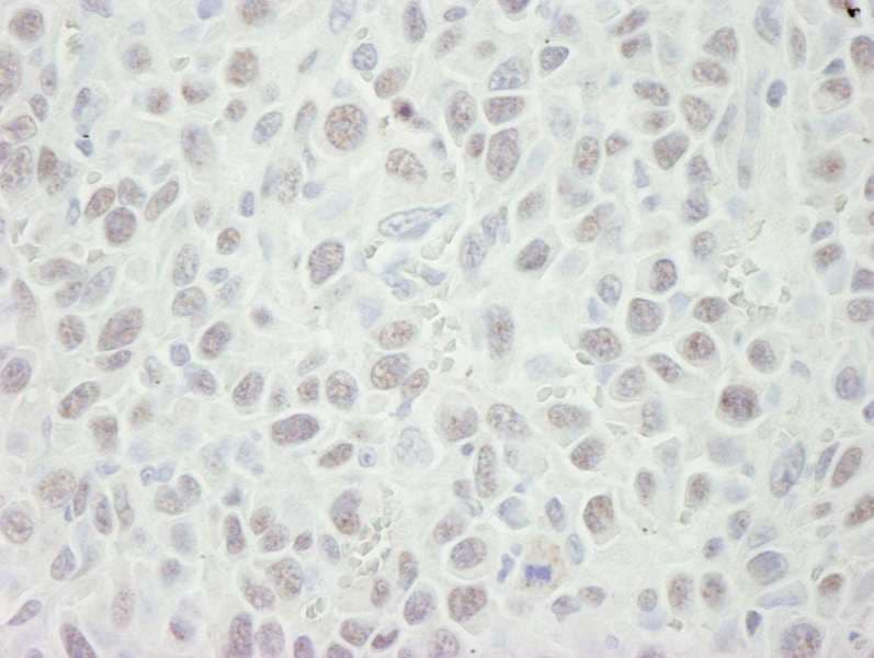 MCM5 Antibody (aa1-50)