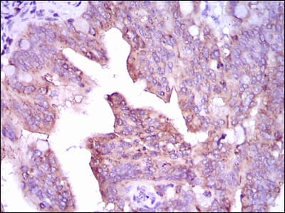CAMK4 / CaMK IV Antibody (clone 8C5B8)