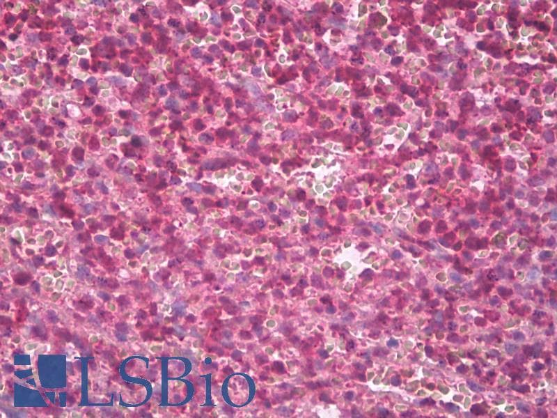IHC-plus™ AHSA1 / AHA1 Antibody