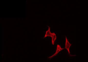 MMP13 Antibody
