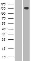 HEPHL1 Protein (Over-Expression Lysate Myc-DDK (Flag))