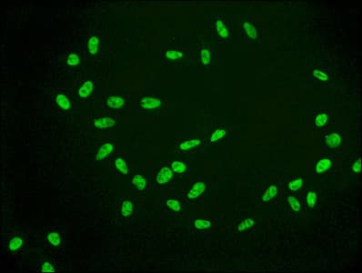 HIST1H2AB Antibody