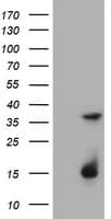 PathPlus™ TS / Thymidylate Synthase Antibody (clone 3F1)