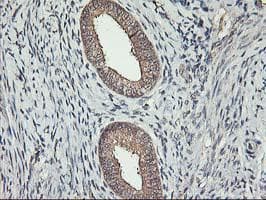 ERBB2 / HER2 Antibody (aa676-1255, clone OTI3F11, Carrier-free)