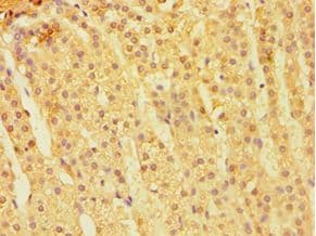 Polyclonal Rabbit anti-Human CARD9 Antibody (aa237-536, IHC, WB)