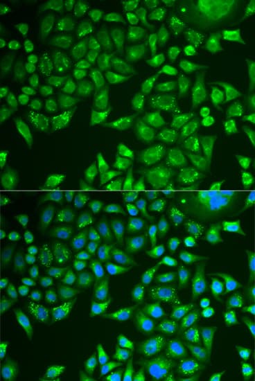 Polyclonal Rabbit anti-Human PNLIP / PL / Pancreatic Lipase Antibody (IHC, IF, WB)