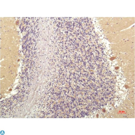 Monoclonal Mouse anti-Human SGK1 / SGK Antibody (IHC)