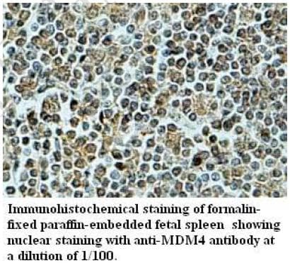 Polyclonal Rabbit anti-Human MDM4 / MDMX Antibody (aa2-113, IHC, WB)