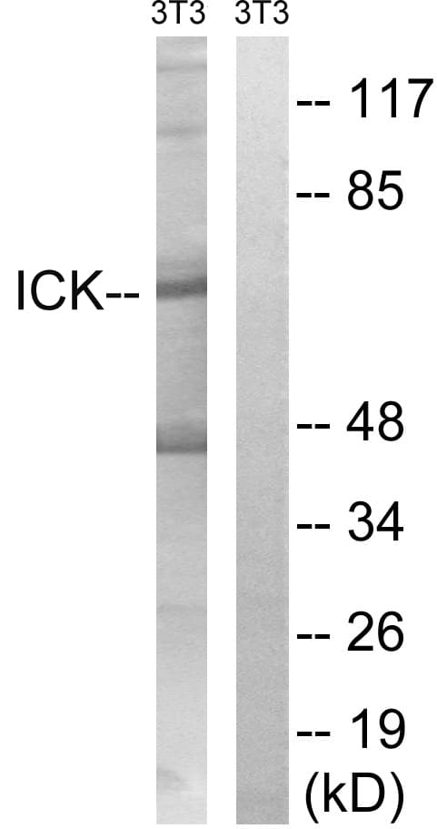 Polyclonal Rabbit anti-Human ICK Antibody (aa125-174, WB)