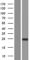 TMEM91 Protein (Over-Expression Lysate Myc-DDK (Flag))