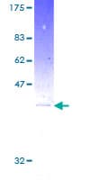 Human ARF1 Protein (Recombinant GST)