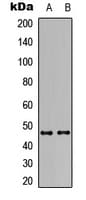 AVPR1B Antibody (Internal)
